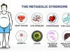 Memahami Sindrom Metabolik: Gejala, Penyebab, dan Cara Mencegahnya