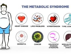 Memahami Sindrom Metabolik: Gejala, Penyebab, dan Cara Mencegahnya